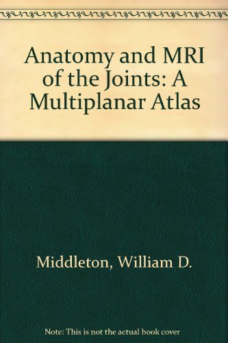 Anatomy and Mri of the Joints: A Multiplanar Atlas (9780881674552) by Middleton, William D.; Lawson, Thomas L.