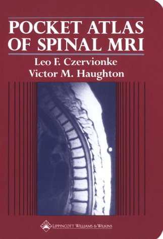 Stock image for Pocket Atlas of Spinal Mri for sale by HPB Inc.