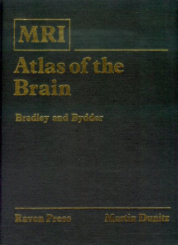 Beispielbild fr Mri Atlas of the Brain zum Verkauf von HPB-Red