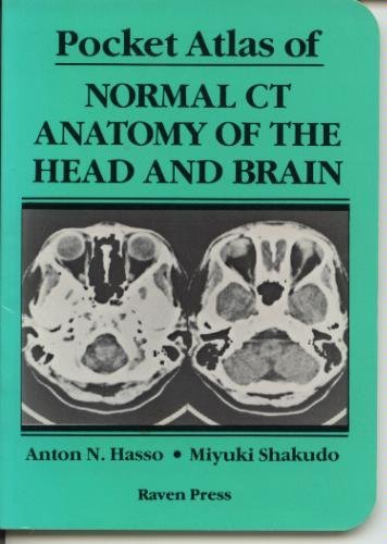 Imagen de archivo de Pocket Atlas of Normal Ct Anatomy of the Head and Brain a la venta por Books of the Smoky Mountains