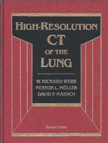 Imagen de archivo de High-Resolution Ct of the Lung a la venta por HPB-Red