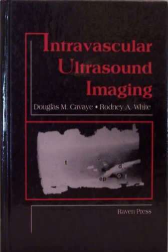 Stock image for Intravascular Ultrasound Imaging for sale by BookHolders