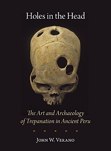 Beispielbild fr Holes in the Head: The Art and Archaeology of Trepanation in Ancient Peru (Dumbarton Oaks Pre-Columbian Art and Archaeology Studies Series) zum Verkauf von BooksRun