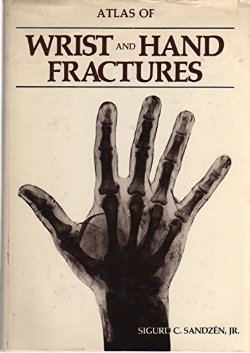 Imagen de archivo de Atlas of Wrist and Hand Fractures a la venta por Bingo Books 2