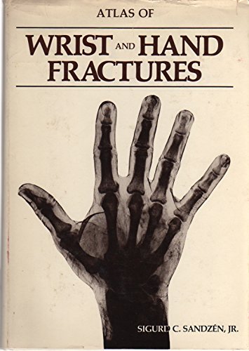 Stock image for Atlas of wrist and hand fractures for sale by HPB-Red