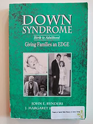 Imagen de archivo de Down Syndrome : Birth to Adulthood (Giving Families an Edge) a la venta por Better World Books