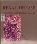 Imagen de archivo de Renal Disease: Classification and Atlas of Infectious and Tropical Diseases a la venta por HPB-Red