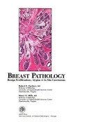 9780891892984: Breast Pathology: Benign Proliferations Atypias and in Situ Carcinomas