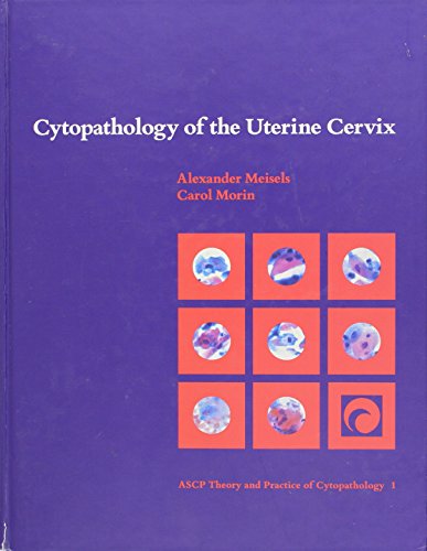 Stock image for Cytopathology of the Uterine Cervix (Ascp Theory and Practice of Cytopathology, Vol 1) for sale by Red's Corner LLC