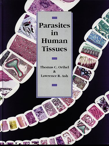 Stock image for Parasites in Human Tissues for sale by Wizard Books