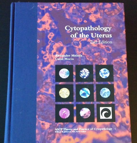 Imagen de archivo de Cytopathology of the Uterus (Ascp Theory and Practice of Cytopathology, 1) a la venta por HPB-Red