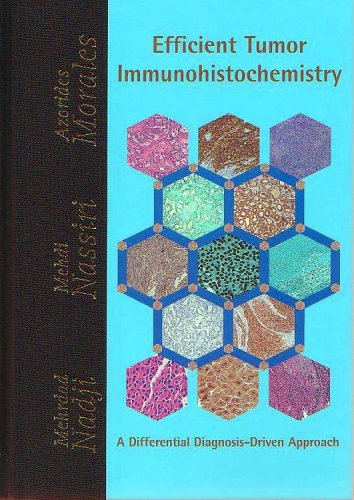 Beispielbild fr Efficient Tumor Immunohistochemistry zum Verkauf von International Book Project