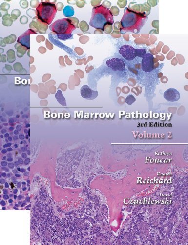 Stock image for Bone Marrow Pathology, Third Edition (2 Vol set) for sale by Goodwill of Colorado