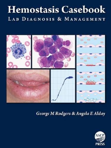 Beispielbild fr Hemostasis Casebook: Lab Diagnosis & Management zum Verkauf von Pieuler Store