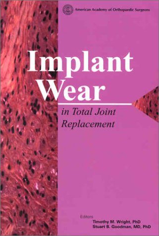 Beispielbild fr Implant Wear in Total Joint Replacement: Clinical and Biological Issues, Material and Design Considerations zum Verkauf von AwesomeBooks