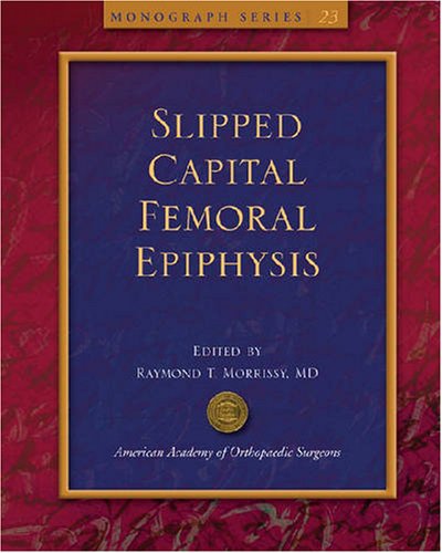 Slipped Capital Femoral Epiphysis (Monograph Series) (9780892032860) by Raymond T. Morrissy