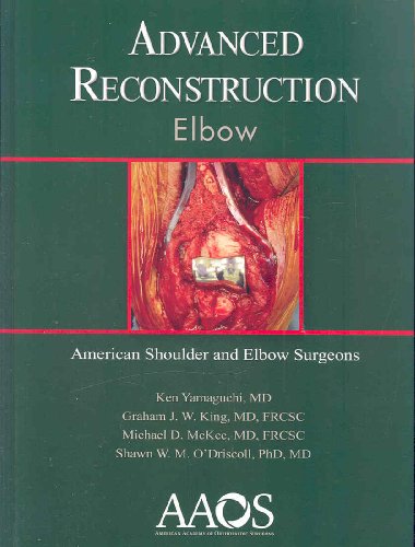 9780892033911: Advanced Reconstruction Elbow