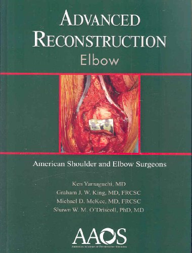 Advanced Reconstruction Elbow (9780892033911) by Ken Yamaguchi M.D.