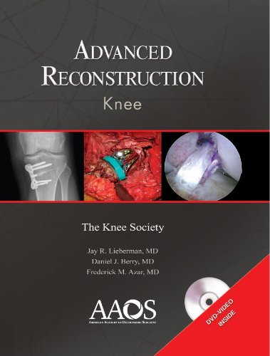 Imagen de archivo de Advanced Reconstruction: Knee a la venta por HPB-Red