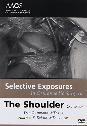 Selective Exposures In Orthopaedic Surgery: The Shoulder 2 (9780892034611) by Dan; M.D. Guttmann