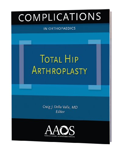 Imagen de archivo de Complications in Orthopaedics: Total Hip Arthroplasty a la venta por HPB-Red