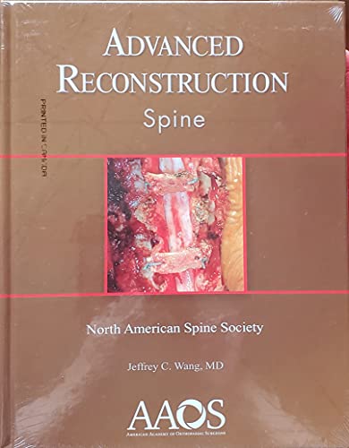 Stock image for Advanced Reconstruction: Spine for sale by Better World Books