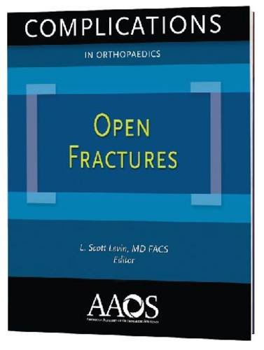 Beispielbild fr Complications in Orthopaedics: Open Fractures (Monograph Series (American Academy of Orthopaedic Surgeons)) zum Verkauf von AwesomeBooks