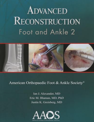 9780892038442: Advanced Reconstruction: Foot and Ankle 2
