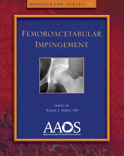 Imagen de archivo de Femoroacetabular Impingement (Monograph) a la venta por Solr Books