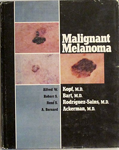 Stock image for Malignant Melanoma for sale by HPB-Red