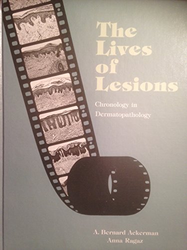 Beispielbild fr The Lives of Lesions: Chronology in Dermatopathology zum Verkauf von GoldBooks