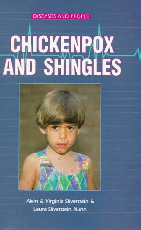 Chicken Pox and Shingles (Diseases and People) (9780894907159) by Silverstein, Alvin; Silverstein, Virginia B.; Nunn, Laura Silverstein