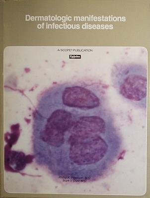 9780895010124: Dermatologic manifestations of infectious diseases (A Scope publication)