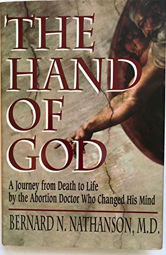 Beispielbild fr The Hand of God : A Journey from Death to Life by the Abortion Doctor Who Changed His Mind zum Verkauf von Better World Books