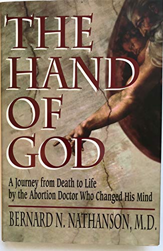 Imagen de archivo de Hand of God: A Journey from Death to Life by the Abortion Doctor Who Changed His Mind a la venta por ThriftBooks-Dallas