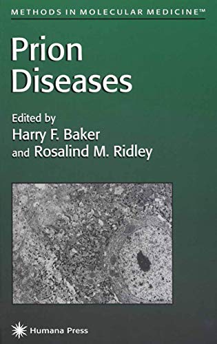 Stock image for Prion Diseases (Methods in Molecular Medicine, 3) for sale by HPB-Red