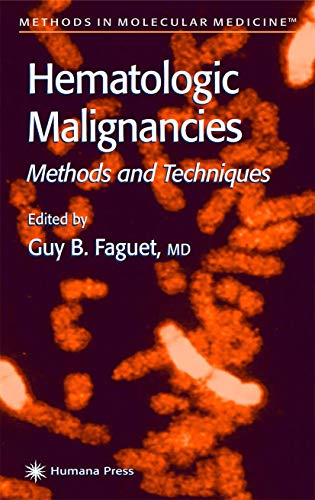 Stock image for Hematologic Malignancies: Methods and Techniques (Methods in Molecular Medicine): 55 for sale by AwesomeBooks