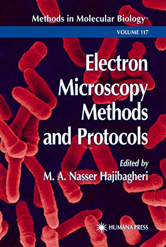 9780896036406: Electron Microscopy Methods and Protocols: v. 117 (Methods in Molecular Biology)