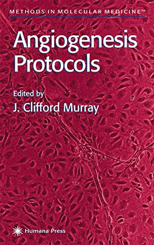 Stock image for Angiogenesis Protocols (Methods in Molecular Medicine) for sale by Solr Books