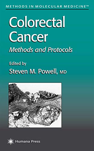Stock image for Colorectal Cancer : Methods and Protocols for sale by Better World Books Ltd