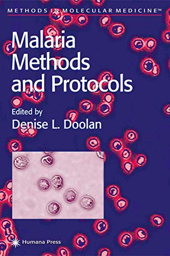 Malaria Methods and Protocols (Methods in Molecular Medicine, 72, Band 72) - Denise L. Doolan