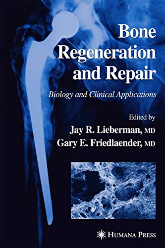 9780896038479: Bone Regeneration and Repair: Biology and Clinical Applications