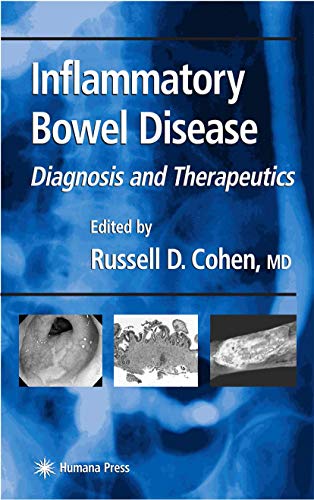 Stock image for Inflammatory Bowel Disease: Diagnosis and Therapeutics (Clinical Gastroenterology) for sale by HPB-Red