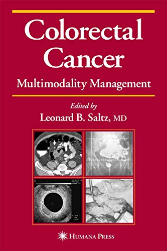 Stock image for Colorectal Cancer : Multimodality Management for sale by Better World Books