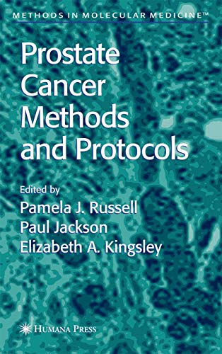 9780896039780: Prostate Cancer Methods and Protocols (Methods in Molecular Medicine, 81)