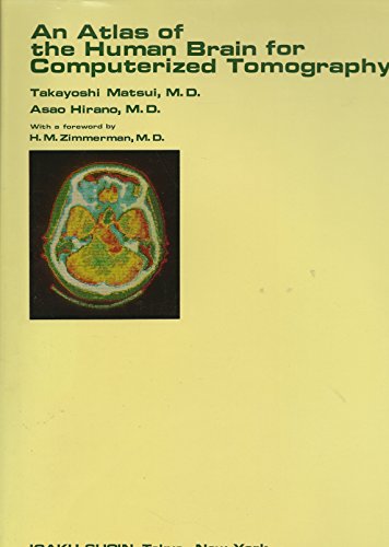 Imagen de archivo de Atlas of the Human Brain for Computerized Tomography a la venta por Chapter 2 Books
