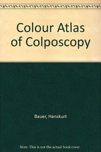 Beispielbild fr Color atlas of colposcopy zum Verkauf von ThriftBooks-Atlanta