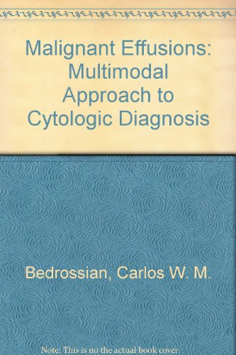 Imagen de archivo de Malignant Effusions: A Multimodel Approach to Cytologic Diagnosis a la venta por Symbilbooks