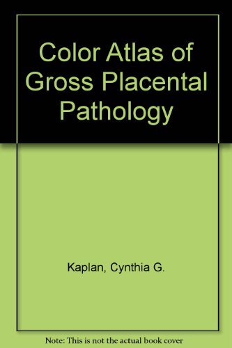 Beispielbild fr Color Atlas of Gross Placental Pathology zum Verkauf von Red's Corner LLC