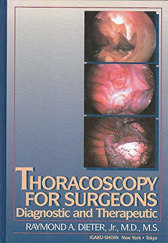 Thoracoscopy for Surgeons: Diagnostic and Therapeutic